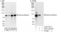 Detection of human Gamma-Adducin by west