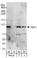 Detection of human Glis1 by western blot