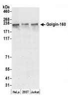Detection of human Golgin-160 by western