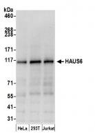 Detection of human HAUS6 by western blot