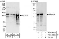 Detection of human HDAC4 by western blot
