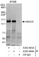 Detection of human HDAC5 by western blot