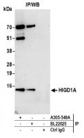 Detection of human HIGD1A by western blo