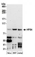 Detection of human HPS4 by western blot.