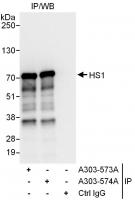 Detection of human HS1 by western blot o