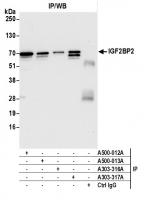 Detection of human IGF2BP2 by WB of immu