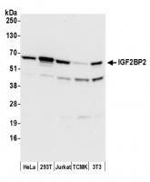Detection of human and mouse IGF2BP2 by 