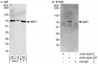 Detection of human IMP1 by western blot 