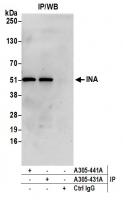 Detection of human INA by western blot o