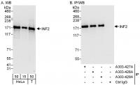 Detection of human INF2 by western blot 