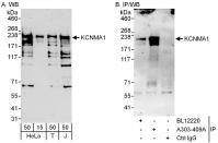 Detection of human KCNMA1 by western blo