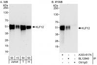 Detection of human KLF12 by western blot