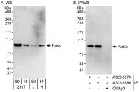 Detection of human Kaiso by western blot