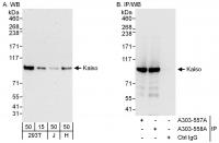 Detection of human Kaiso by western blot
