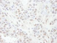 Detection of human LEF1 by immunohistoch