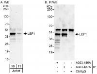Detection of human LEF1 by western blot 