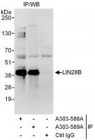 Detection of human LIN28B by western blo