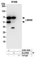 Detection of human LMAN2 by western blot