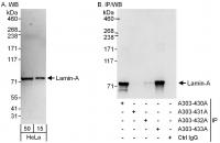 Detection of human Lamin-A by western bl
