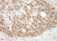 Detection of human MBD3 by immunohistoch