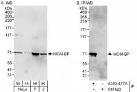 Detection of human MCM-BP by western blo