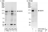 Detection of human MDR1/ABCB1 by western