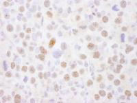 Detection of mouse MEF2A by immunohistoc