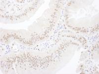 Detection of human MEF2A by immunohistoc