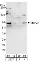 Detection of human MEF2A by western blot