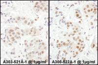 Detection of human MEF2D by immunohistoc