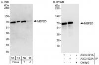 Detection of human MEF2D by western blot