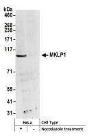 Detection of human MKLP1 by western blot