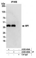 Detection of human MPI by western blot o