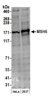 Detection of human MSH6 by western blot.