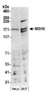 Detection of human MSH6 by western blot.