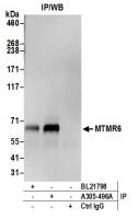 Detection of human MTMR6 by western blot