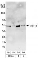Detection of human Mel-18 by western blo
