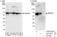 Detection of human and mouse MetAP2 by w
