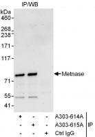 Detection of human Metnase by western bl