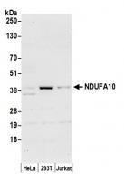 Detection of human NDUFA10 by western bl