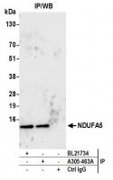 Detection of human NDUFA5 by western blo