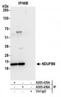 Detection of human NDUFB6 by western blo