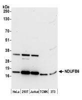 Detection of human and mouse NDUFB6 by w