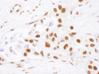 Detection of human NF90 by immunohistoch
