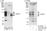 Detection of human NFATc1 by western blo
