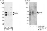 Detection of human NFIB by western blot 