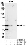 Detection of human NGLY1 by western blot