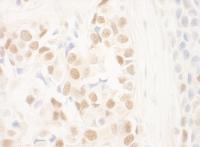 Detection of human NRIP by immunohistoch