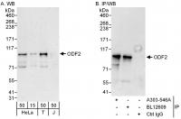 Detection of human ODF2 by western blot 