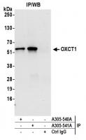 Detection of human OXCT1 by western blot